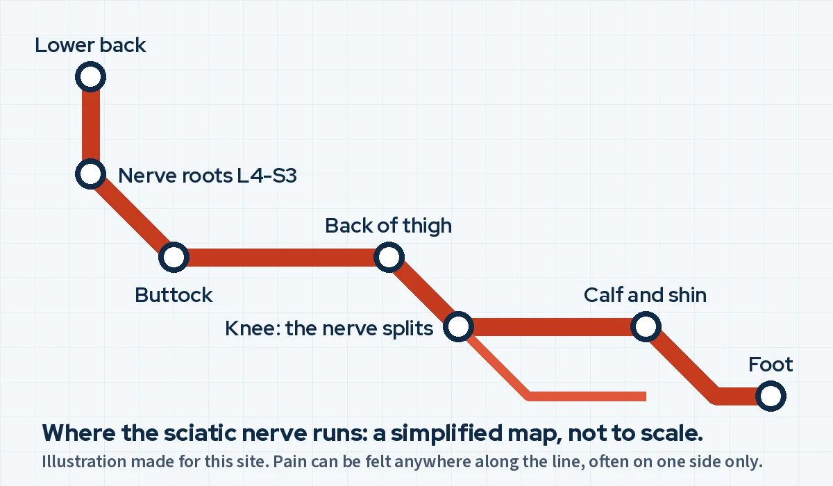 Illustration of the sciatic nerve drawn as a transit line with stations from the lower back to the foot